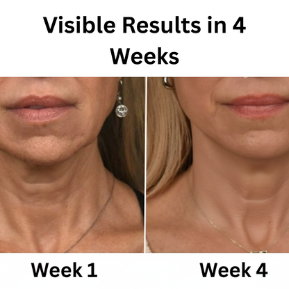 Neux Radiance Mobilteil